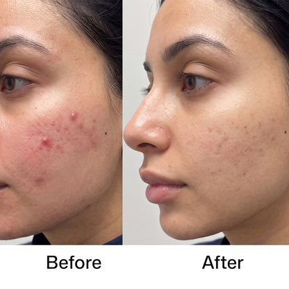 Pore Minimizing Face Wash